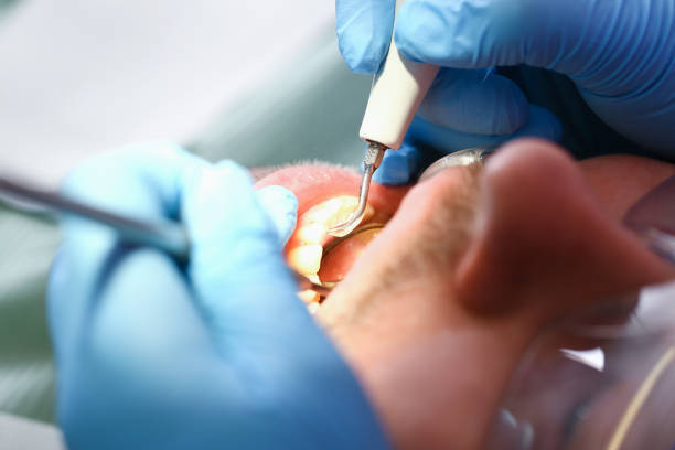 Best Walk-In Emergency Dentist in Hollywood, FL